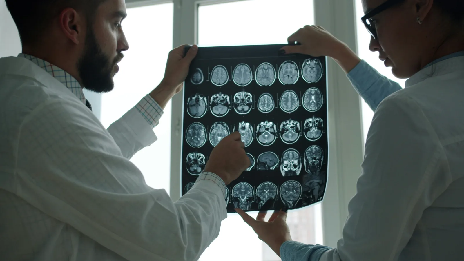 Radiologists reviewing a brain MRI scan for CPT coding
